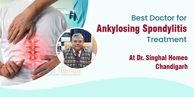 Ankylosing Spondylitis Treatment