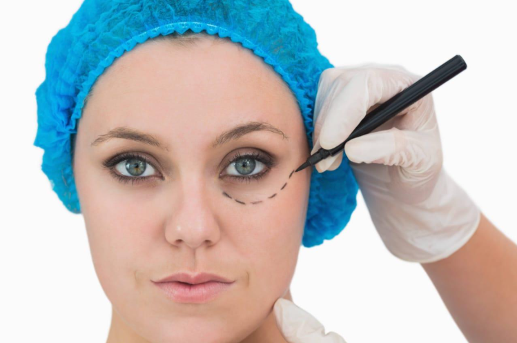 Blepharoplasty Surgery Delhi:  Is There a Right Age for Eyelid Surgery?